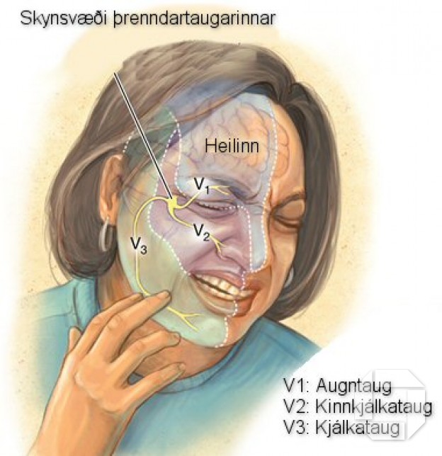 Andlits- og kjálkaverkir (Orofacial Pains) - I. Hluti